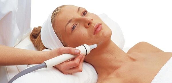 Peeling Facial